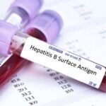 ارتودنسی در افراد مبتلا به هپاتیت آیا امکان پذیر است؟