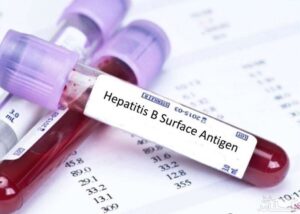 ارتودنسی در افراد مبتلا به هپاتیت آیا امکان پذیر است؟