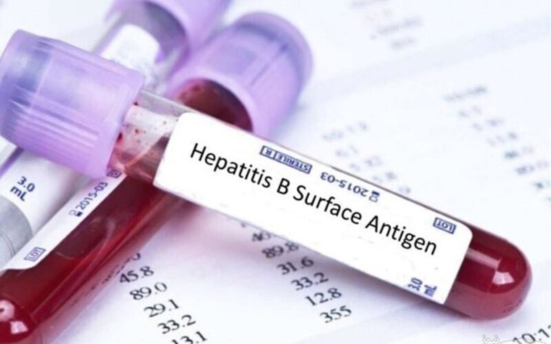 ارتودنسی در افراد مبتلا به هپاتیت آیا امکان پذیر است؟